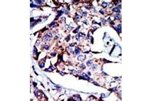Image no. 2 for anti-Diacylglycerol Kinase, delta 130kDa (DGKD) (C-Term) antibody (ABIN360608)