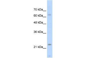 Image no. 1 for anti-Slow Skeletal Troponin I (TNNI1) (Middle Region) antibody (ABIN2777152)