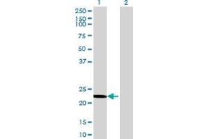 OVCA2 antibody  (AA 1-227)
