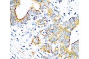 Immunohistochemistry of paraffin-embedded Human stomach using MTCO2 Polyclonal Antibody at dilution of 1:100 (40x lens).