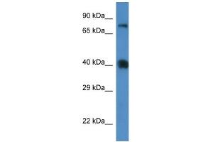 Image no. 1 for anti-Solute Carrier Family 7 (Cationic Amino Acid Transporter, Y+ System), Member 3 (SLC7A3) (Middle Region) antibody (ABIN2781563)