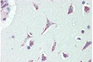 Image no. 1 for anti-Cancer Susceptibility Candidate 4 (CASC4) (AA 336-365) antibody (ABIN1977267)