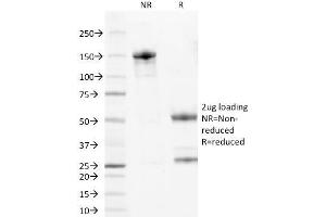 Image no. 1 for anti-Wilms Tumor 1 (WT1) (AA 1-181) antibody (ABIN6940900)