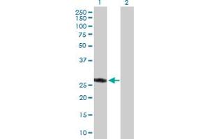 Image no. 1 for anti-Ankyrin Repeat and SOCS Box Containing 9 (ASB9) (AA 1-294) antibody (ABIN530782)