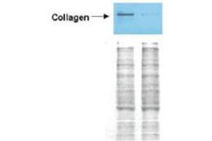 Image no. 2 for anti-Collagen, Type I (COL1) antibody (ABIN5596819)