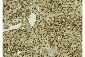 Image no. 1 for anti-Squamous Cell Carcinoma Antigen Recognized By T Cells (SART1) antibody (ABIN6264926)