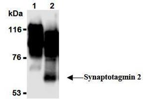 Image no. 2 for anti-Synaptotagmin II (SYT2) (AA 1-20), (N-Term) antibody (ABIN1449191)