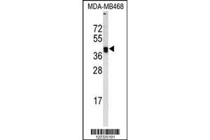 Image no. 2 for anti-Lysyl Oxidase (LOX) (AA 234-260) antibody (ABIN653071)