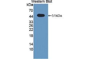 Image no. 1 for anti-Sprouty-Related, EVH1 Domain Containing 2 (SPRED2) (AA 1-418) antibody (ABIN5014345)