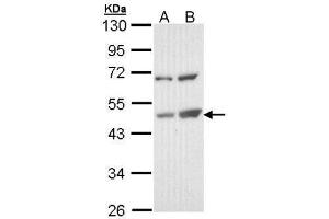 Image no. 3 for anti-TSPY-Like 1 (TSPYL1) (Center) antibody (ABIN2856704)