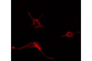 Image no. 2 for anti-Adenylate Cyclase 6 (ADCY6) (Internal Region) antibody (ABIN6257031)