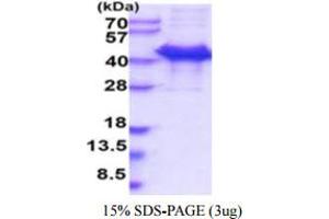 Image no. 1 for Calumenin (CALU) (AA 20-315) protein (ABIN5854970)