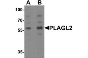 Image no. 1 for anti-Pleiomorphic Adenoma Gene-Like 2 (PLAGL2) (N-Term) antibody (ABIN1449972)
