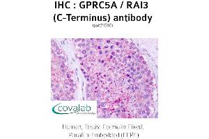 Image no. 2 for anti-G Protein-Coupled Receptor, Family C, Group 5, Member A (GPRC5A) (C-Term) antibody (ABIN1735208)