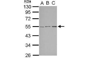 WB Image Sample (30 ug of whole cell lysate) A: A549 B: HepG2 C: HCT116 10% SDS PAGE antibody diluted at 1:1000