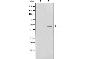 Image no. 2 for anti-Transcription Factor AP-2 alpha (Activating Enhancer Binding Protein 2 Alpha) (TFAP2A) antibody (ABIN6259961)