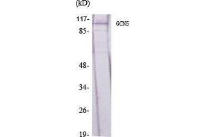 Image no. 2 for anti-K(lysine) Acetyltransferase 2A (KAT2A) (C-Term) antibody (ABIN3184765)