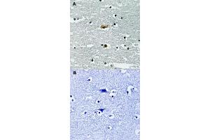 Image no. 1 for anti-serine threonine Kinase 39 (STK39) (pSer309) antibody (ABIN5588902)