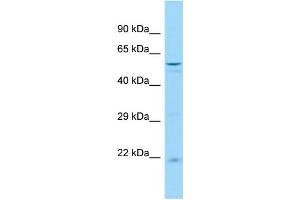 Image no. 1 for anti-Ubiquitin Specific Peptidase 44 (USP44) (N-Term) antibody (ABIN2786167)