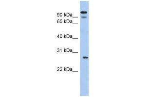 Image no. 1 for anti-Voltage-Dependent Anion Channel 3 (VDAC3) (N-Term) antibody (ABIN633623)