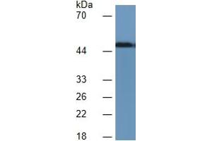Image no. 4 for Leucine-Rich alpha-2 Glycoprotein 1 (LRG1) ELISA Kit (ABIN6730983)