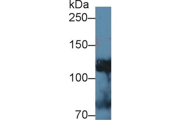 alpha Adducin antibody  (AA 388-560)