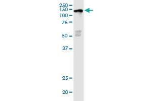 Image no. 2 for anti-Lysine (K)-Specific Demethylase 5D (KDM5D) (AA 127-230) antibody (ABIN2565646)