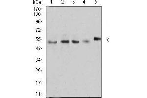 Image no. 8 for anti-CD2 (CD2) (AA 25-140) antibody (ABIN5542296)