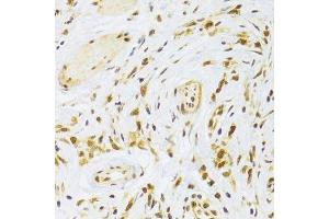 Image no. 6 for anti-Ribosomal Protein L13 (RPL13) antibody (ABIN6147109)