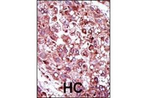Image no. 4 for anti-phosphoenolpyruvate Carboxykinase 1 (Soluble) (PCK1) (AA 592-622), (C-Term) antibody (ABIN1882180)
