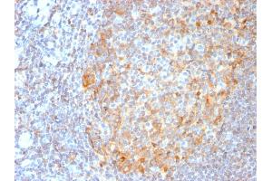 Image no. 2 for anti-Mucosa Associated Lymphoid Tissue Lymphoma Translocation Gene 1 (MALT1) (AA 701-808) antibody (ABIN6939113)