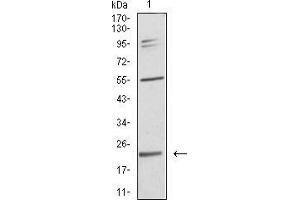 Image no. 3 for anti-Interleukin 28A (Interferon, lambda 2) (IL28A) (AA 1-200) antibody (ABIN5542627)