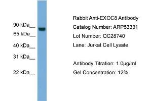Image no. 2 for anti-Exocyst Complex Component 8 (EXO84) (N-Term) antibody (ABIN2785344)
