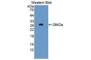 Image no. 1 for anti-Fas-Activated serine/threonine Kinase (FASTK) (AA 330-511) antibody (ABIN5013530)