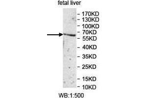 Image no. 1 for anti-UDP Glucuronosyltransferase 1 Family, Polypeptide A1 (UGT1A1) (AA 26-193) antibody (ABIN1857179)