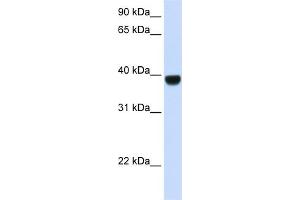 Image no. 1 for anti-Forkhead Box E1 (Thyroid Transcription Factor 2) (FOXE1) (Middle Region) antibody (ABIN2777423)