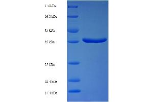 Image no. 1 for Protein Phosphatase, Mg2+/Mn2+ Dependent, 1B (PPM1B) (AA 2-193) protein (His-SUMO Tag) (ABIN5710135)