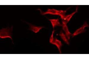 Image no. 1 for anti-Solute Carrier Family 24 Member 3 (SLC24A3) antibody (ABIN6259279)