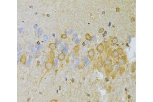 Immunohistochemistry of paraffin-embedded Rat brain using Slug Polyclonal Antibody at dilution of 1:100 (40x lens).
