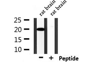 Image no. 3 for anti-RNA Polymerase II TBP-Associated Factor Subunit G (TAF9) (Internal Region) antibody (ABIN6262731)