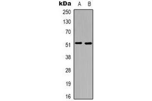 Image no. 2 for anti-Tachykinin Receptor 3 (TACR3) (C-Term) antibody (ABIN2957771)