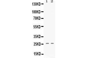 Image no. 1 for anti-Platelet Factor 4 (PF4) (AA 32-101) antibody (ABIN4886692)
