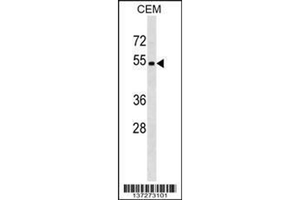 anti-Male-Specific Lethal 2 Homolog (MSL2) (AA 4-32), (N-Term) antibody