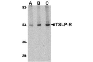 Image no. 2 for anti-Cytokine Receptor-Like Factor 2 (CRLF2) (Middle Region) antibody (ABIN318884)