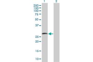 Image no. 1 for anti-SMAD Family Member 9 (SMAD9) (AA 1-225) antibody (ABIN517673)