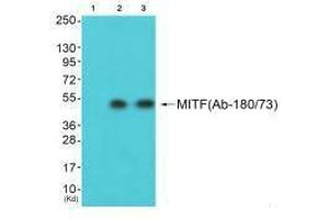 MITF 抗体  (Ser73, Ser180)