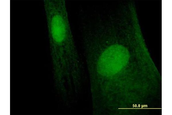 MAGEB6 antibody  (AA 1-407)