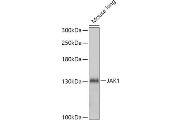 JAK1 Antikörper  (AA 120-380)
