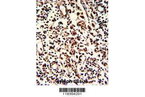 Image no. 2 for anti-KIAA0226 (KIAA0226) (AA 241-271), (N-Term) antibody (ABIN388583)