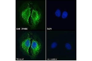 ABIN7013872 Immunofluorescence analysis of paraformaldehyde fixed U2OS cells, permeabilized with 0.